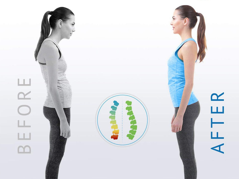 Posture corrector device improving spine alignment and reducing back pain